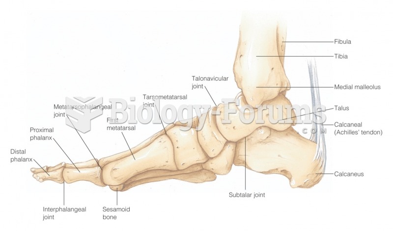 Medial view of joints of right ankle and foot