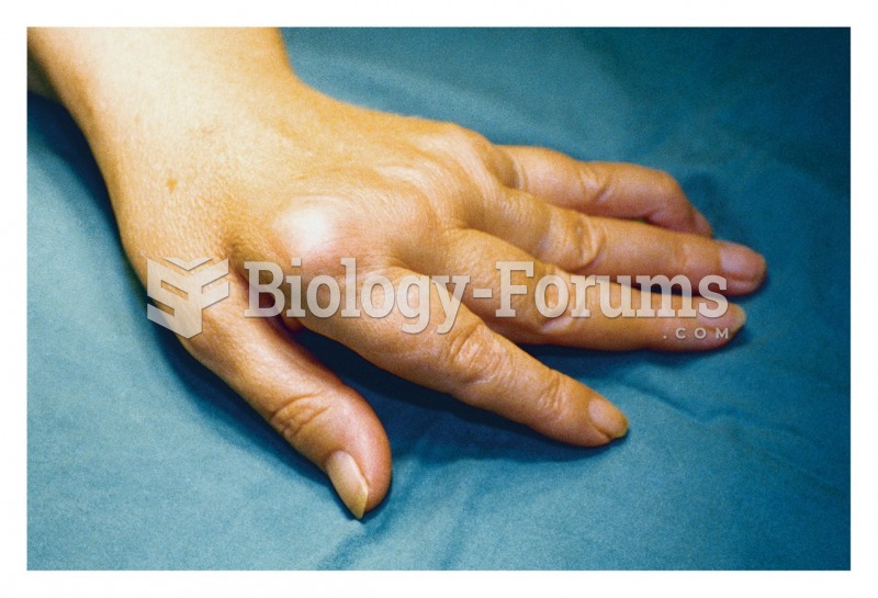 Joint effusion of the hand