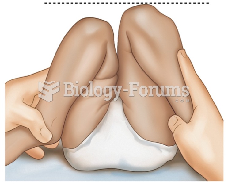 Allis’ sign—demonstration of unequal knee height