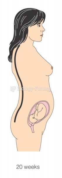 Postural changes with pregnancy in 20 weeks