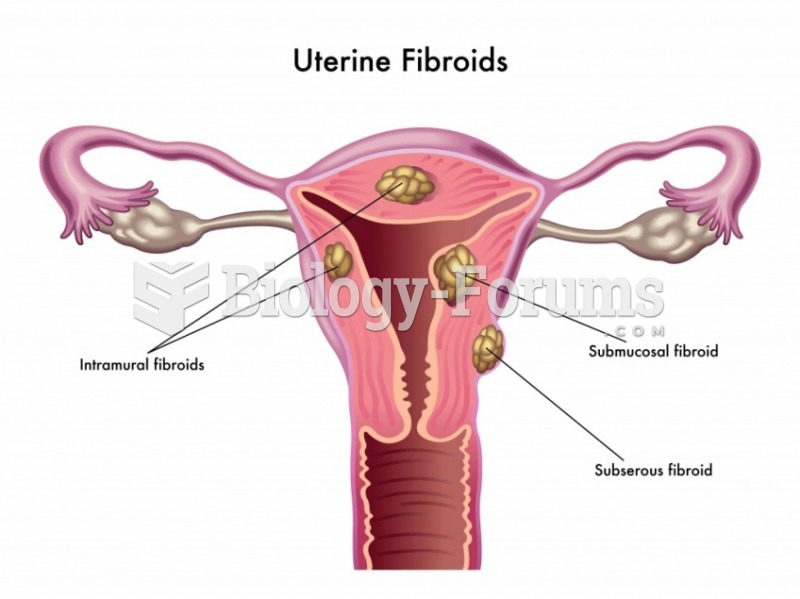 Uterine Fibroids