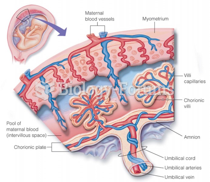 Cross section of the placenta