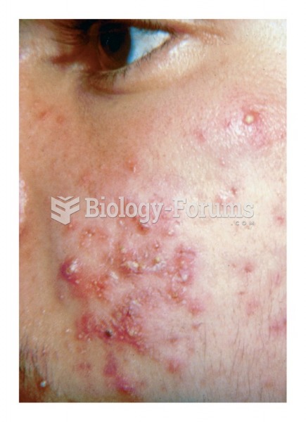 Open and closed comedones of acne