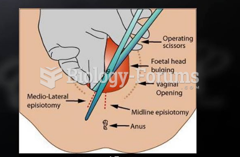 Episiotomy or Vaginal Cutting During Childbirth