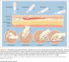 Parenteral Administration