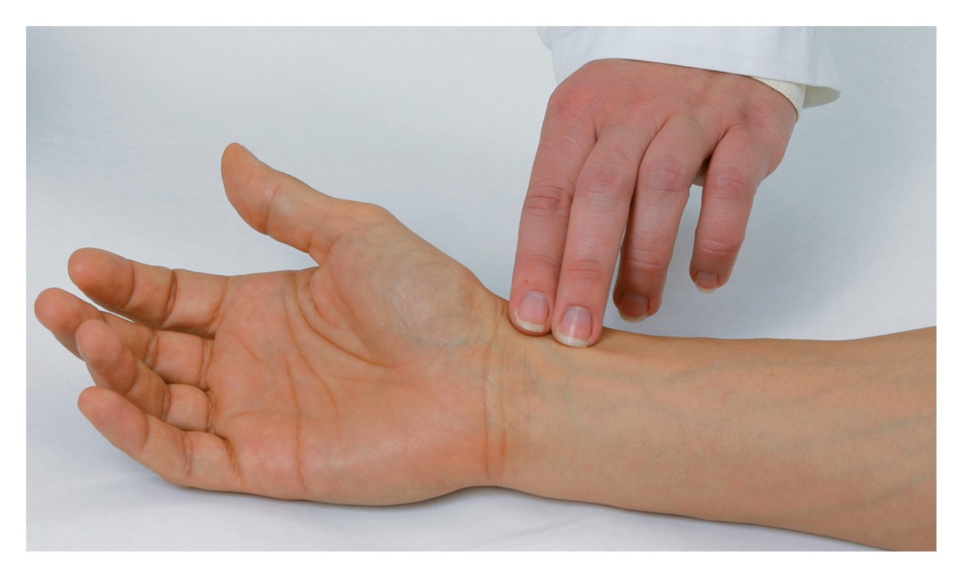 Palpating the radial pulse