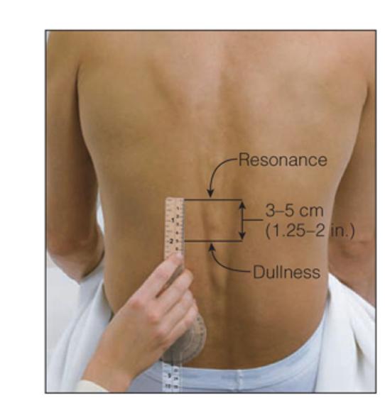 Diaphragmatic movement, measurement