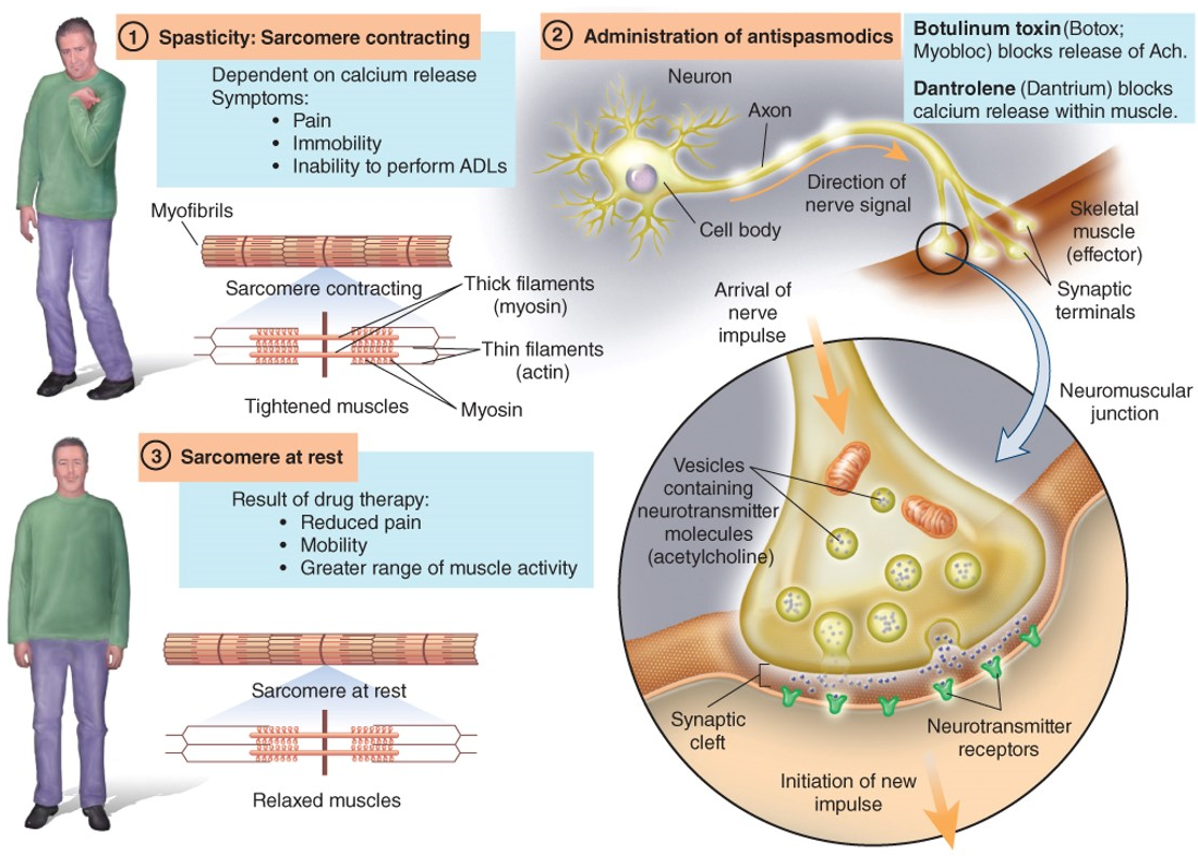 Direct acting of antispasmodic drugs