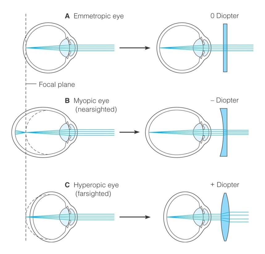 Use of diopter to adjust for problems of refraction