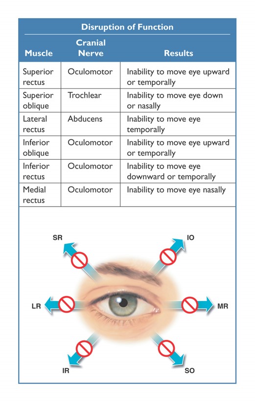 Extraocular muscle abnormalities