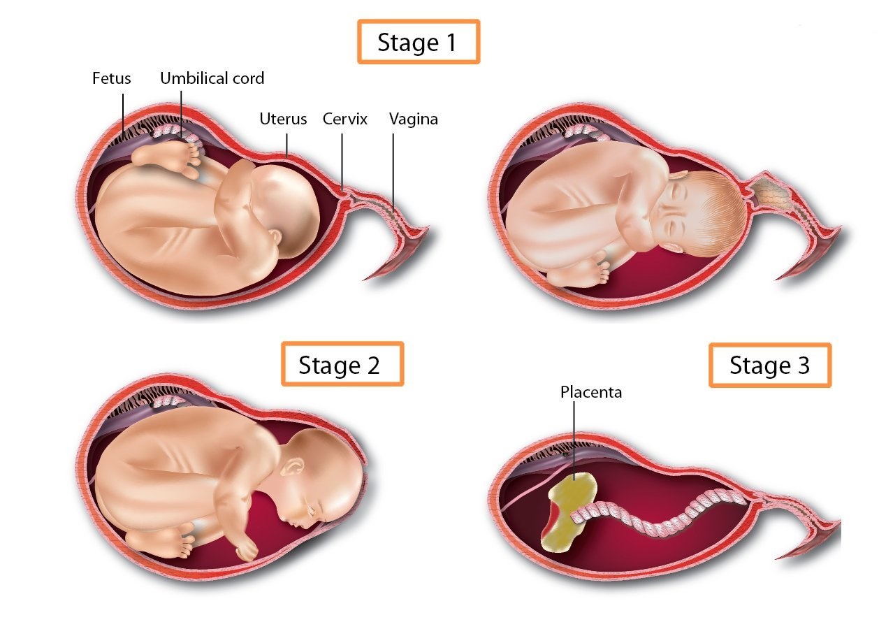 The Stages of Labor and Birth in a Vaginal Delivery