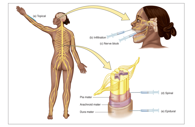 Route for administrative of local anesthesia