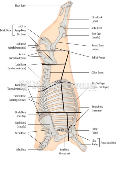 Skeletal Structure of a Steer