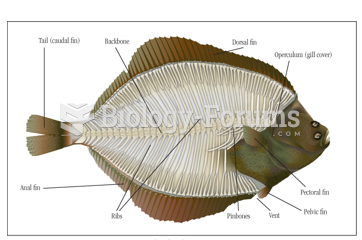Bone structure of a flatfish