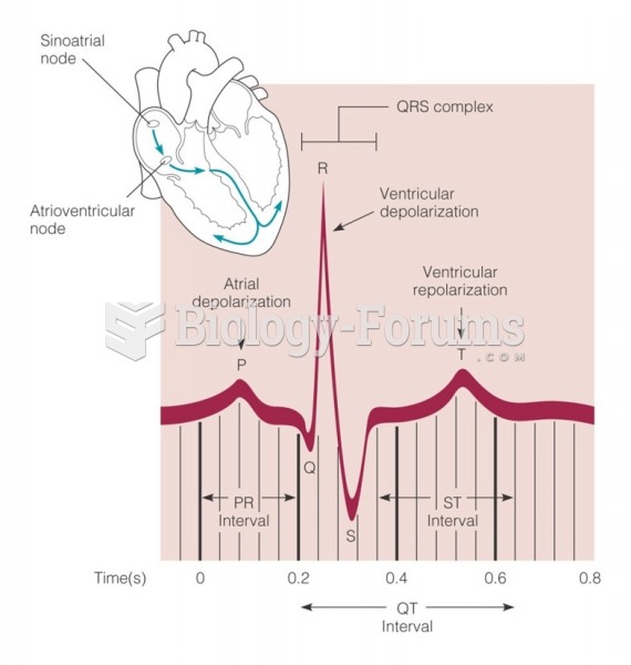 Electrocardiogram wave