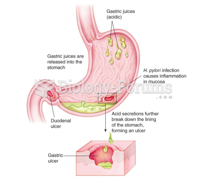 Mechanism of peptic ulcer formation