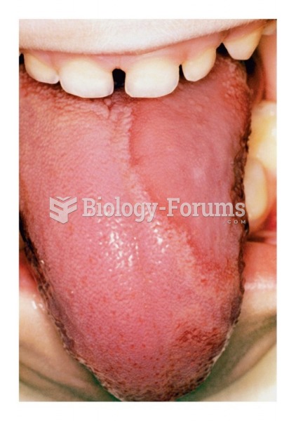 Smooth,glossy tongue (atrophic glossitis)