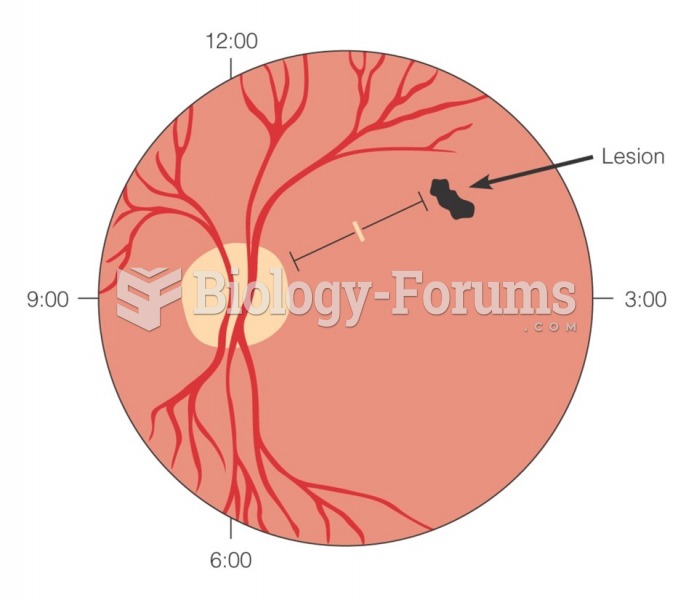 Documenting a finding from the ophthalmoscopic examination