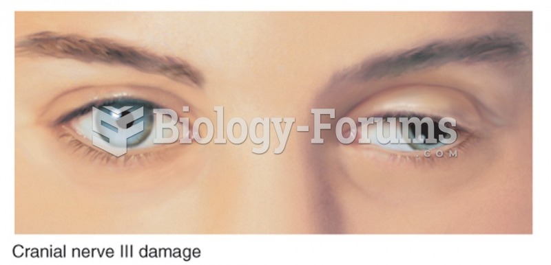 Cranial nerve III damage