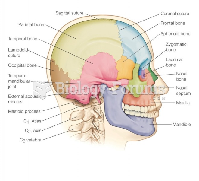 Bones of the head