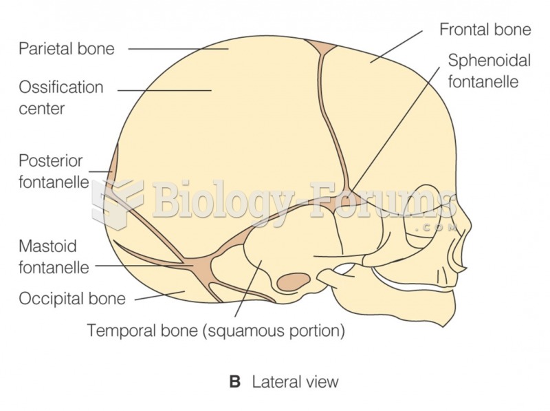 The newborn’s skull