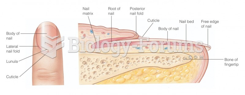 Structure of a nail