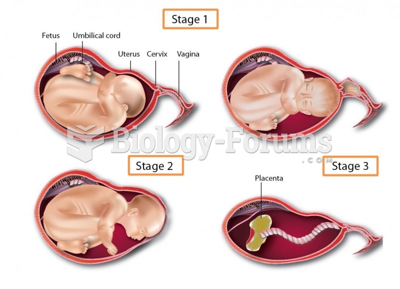 The Stages of Labor and Birth in a Vaginal Delivery