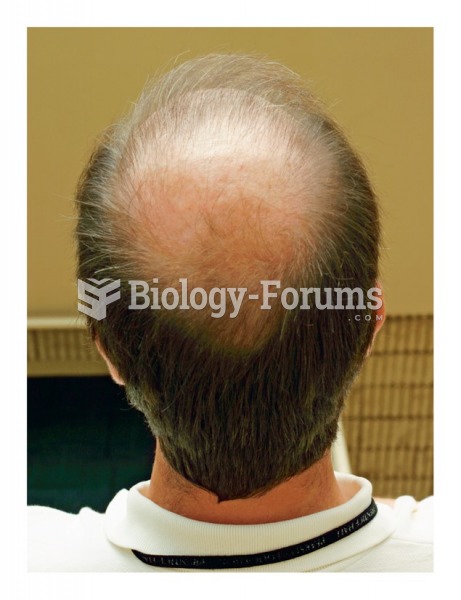 Male pattern baldness