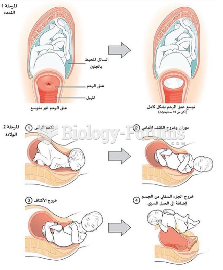 مراحل الولاده "Stages of birth"