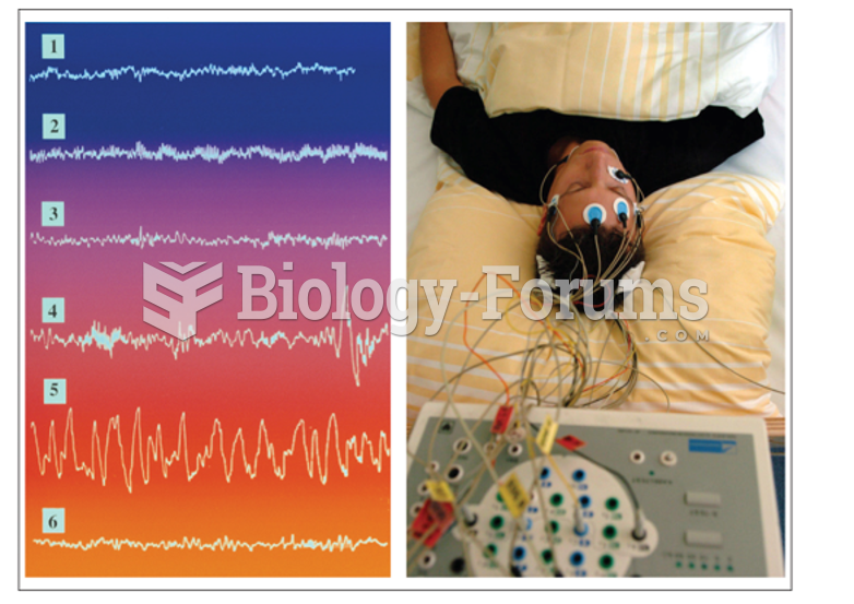 The five stages of sleep