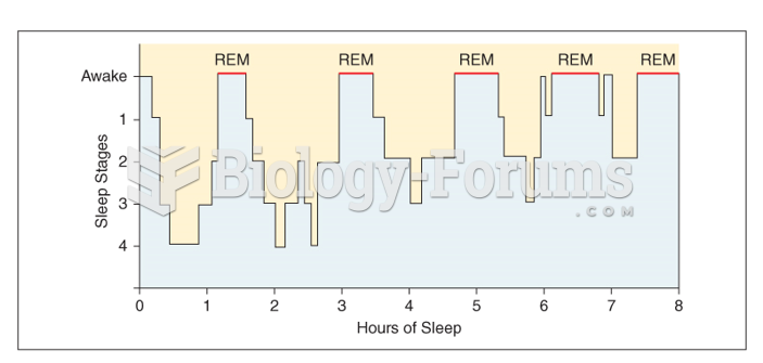 Sleep cycling: stages of healthy sleeping