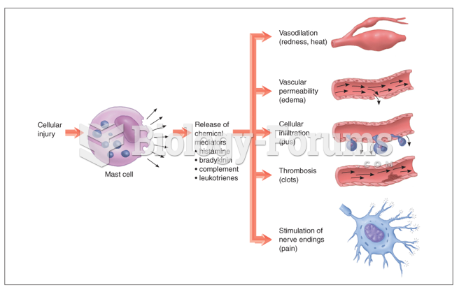 Steps in acute inflammation