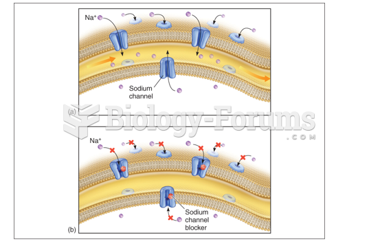 Normal nerve conduction of Sodium ion