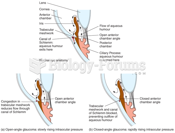 Forms of primary adult glaucoma