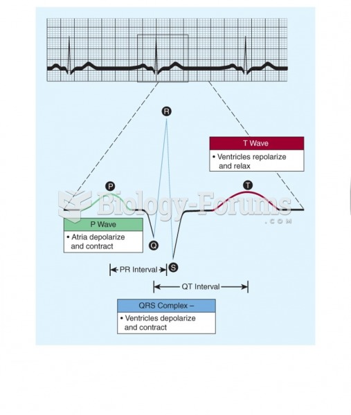 Normal electrocardiogram tracing