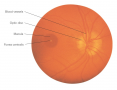 The optic disc