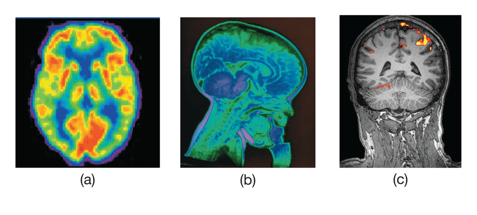 Scanning the Brain