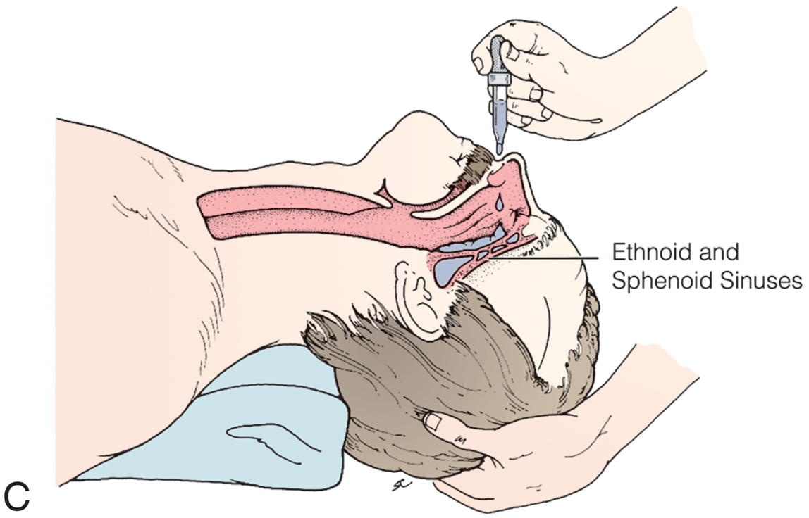 Examples of Nasal Drops