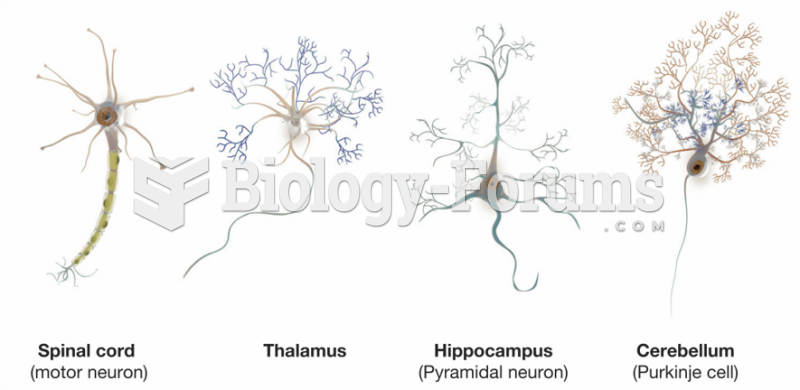 Different Kinds of Neurons