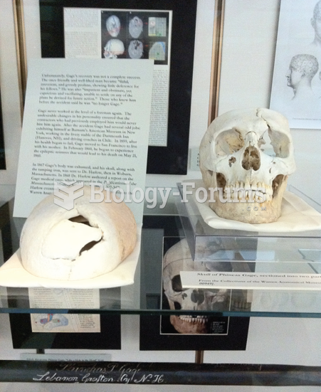 Phineas Gage’s Skull