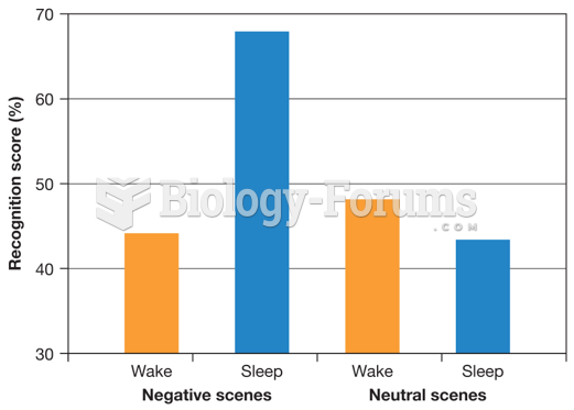 Sleep and Consolidation in Memory