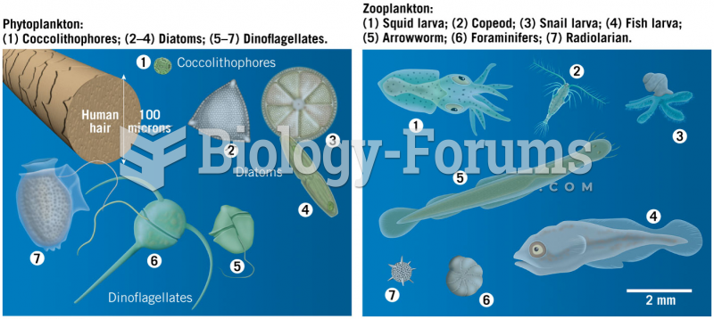 Phytoplankton and Zooplankton "العوالق الحيوانية"