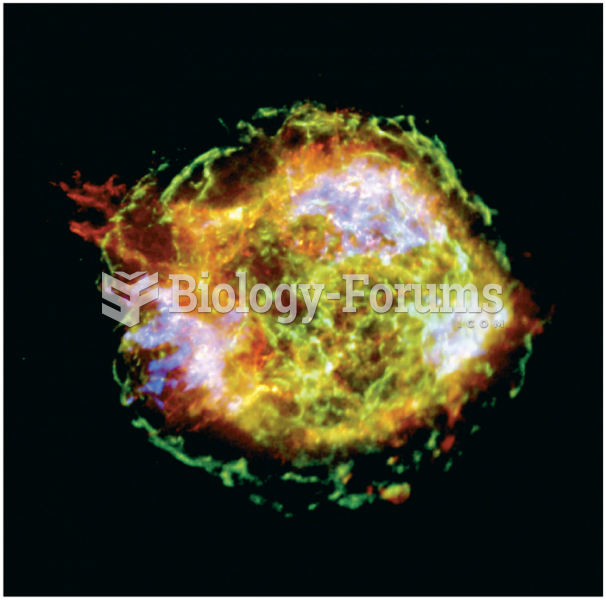 Supernova Remnant Captured by Chandra X-Ray Observatory