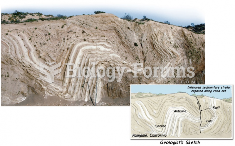 Types of Folds