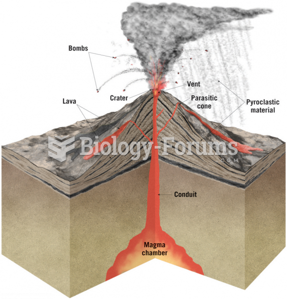 Anatomy of a Volcano