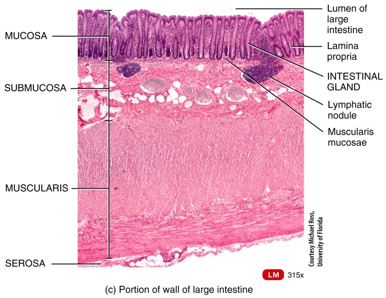 Wall of the Colon