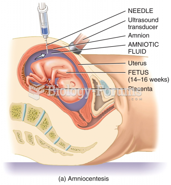 Prenatal Diagnostic Tests