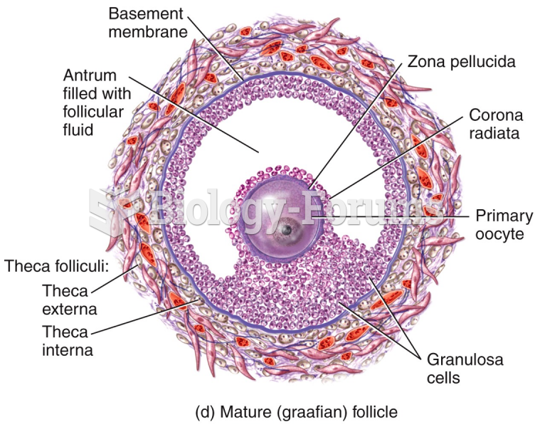 Female Reproductive System - Mature (graafian) follicle "الجهاز التناسلي ...