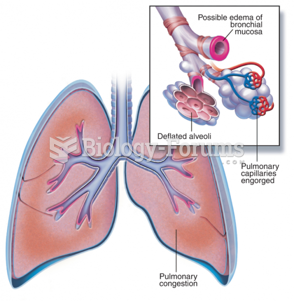 Pulmonary Congestion, which May Result from Congestive Heart Failure