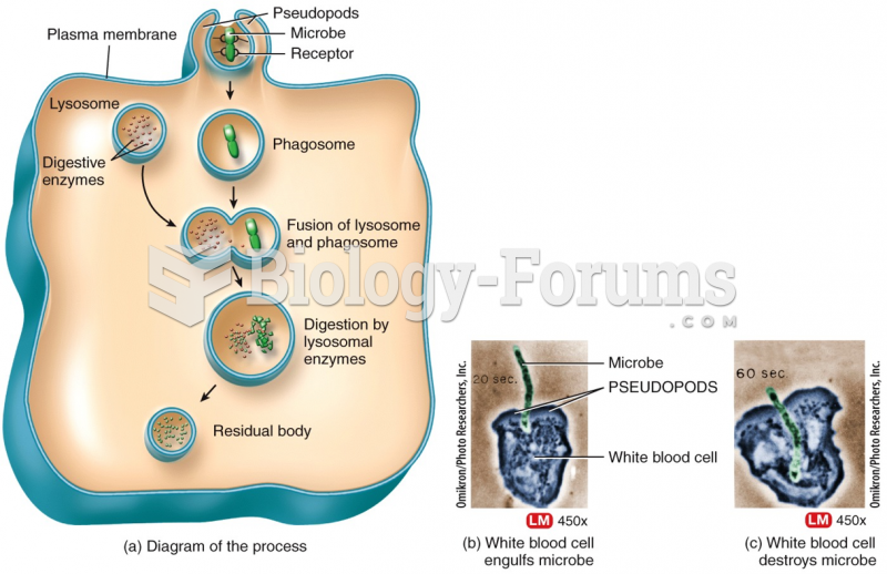 Active Transport in Vesicles: Phagocytosis